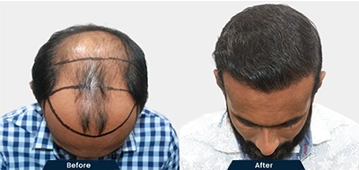 Before and After 2