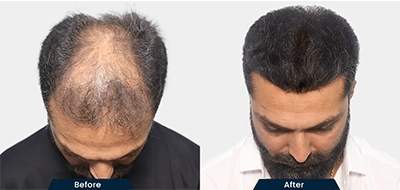 Before and After 3