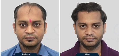 Before and After 4