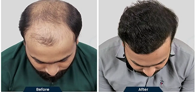 Before and After 5
