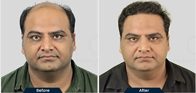 Before and After 6